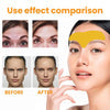 Woman Forehead Smooth Wrinkle Patches