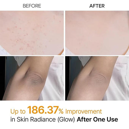 Dr.Melaxin Peel Shot Kojic Acid Spray – Kojic Acid Brightening & Tone Care Spray