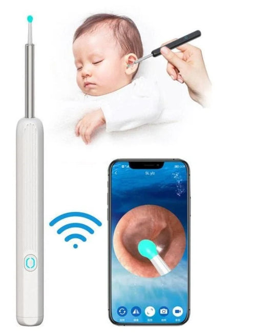 Earwax Removal Kit – Safe & Effective Ear Cleaning Tool Set with LED Light for Gentle Earwax Cleaning at Home